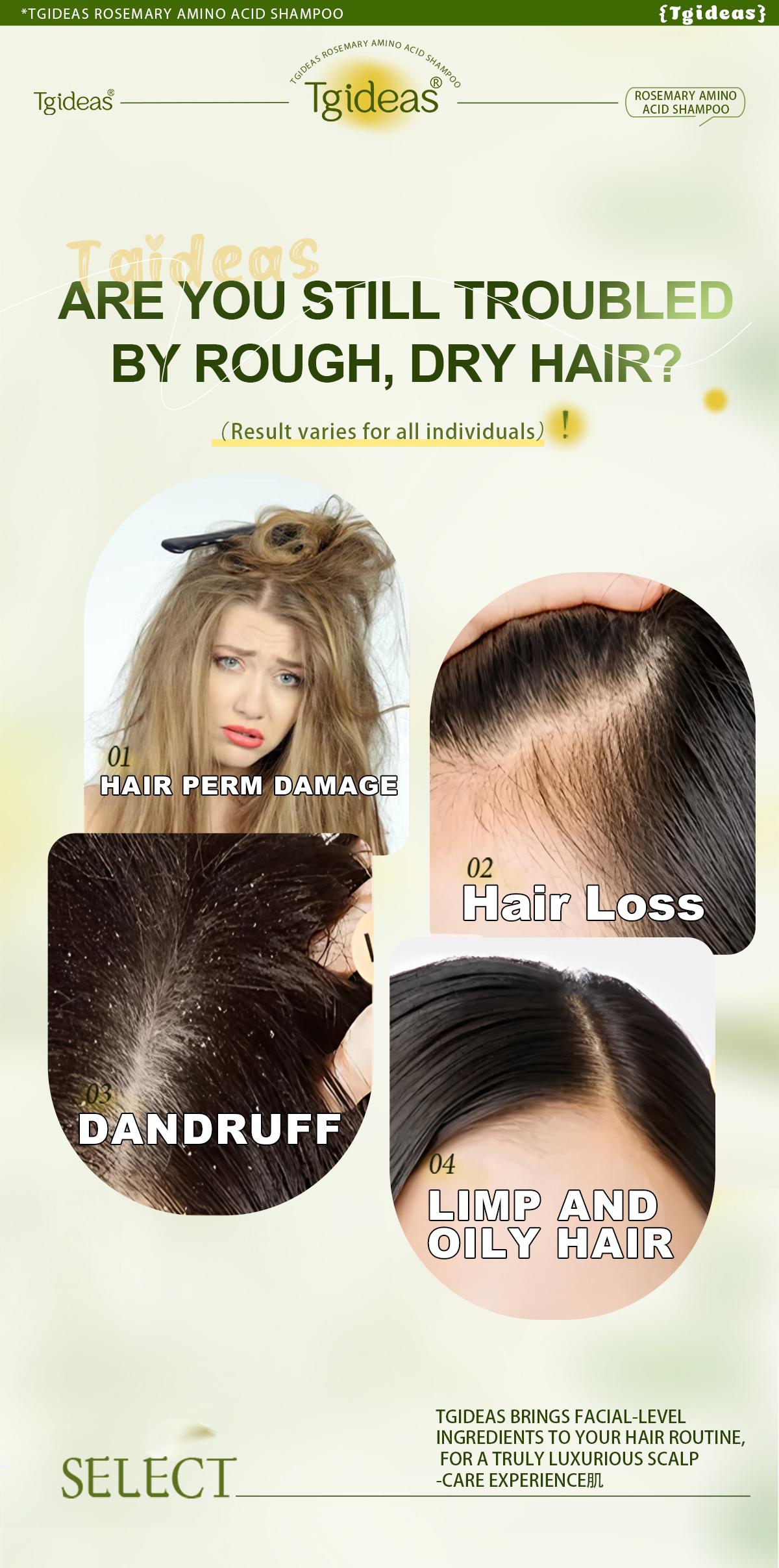 Buy 1 Get 1 Free (Same Model) Tgideas Rosemary Amino Acid Shampoo 250ML - Buy 1 Get 1 Free! Anti-Hair Fall Hair Loss Treatment Oil Control Anti Dandruff Haircare with Silk Amino Acids & Rosemary Essence Buy 1 Get 1 Free (Same Model) Tgideas Rosemary Amino Acid Shampoo 250ML - Buy 1 Get 1 Free! Anti-Hair Fall Hair Loss Treatment Oil Control Anti Dandruff Haircare with Silk Amino Acids & Rosemary Essence