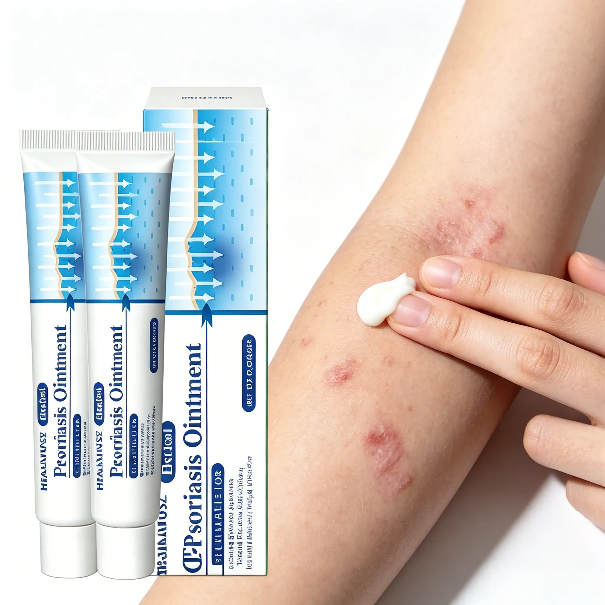 TikTok Viral Psoriasis & Fungus Cream – Extra Strength Natural Formula – Stops Itching Fast, Repairs Dry Flaky Skin – Works for Psoriasis, Ringworm, Jock Itch, Copper Fungus – Deep Hydration, Soothing, Prevents Flare-Ups – Dermatologist Approved – 20g tik