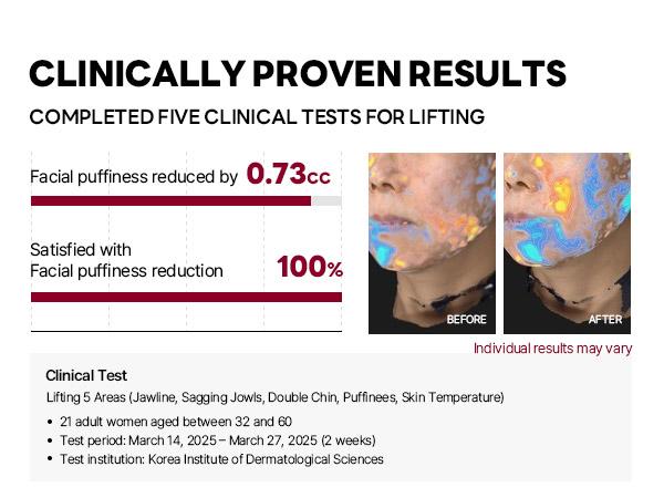 [Viral] Camellia Deep Collagen Chin Lifting Gel Mask – Zempic Neck Solution, Double Chin Reducer, Defined Jawline Shaper,  Firming, Jeju Camellia Ingredients for Skin Repair