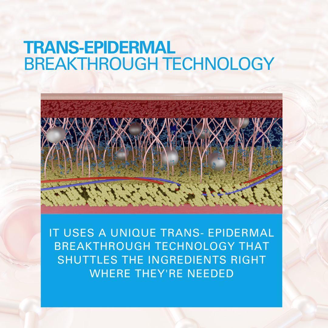 Serious Skincare Trace + Erase Needle-Free Wrinkle Filler with Cross-Linked Hyaluronic Acid – Targets Fine Lines, Deep Wrinkles & Creases – 1 oz Serious Skincare Trace + Erase Needle-Free Wrinkle Filler with Cross-Linked Hyaluronic Acid – Targets Fine Lines, Deep Wrinkles & Creases – 1 oz