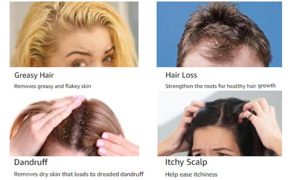 Dual-Effect Bristle Scalp Massage Comb: Dual-zone bristles for targeted care. Deep cleans hair follicles while soothing massage relieves tension. Strengthen roots starting with a healthy scalp. Available in white/pink/gray. Dual-Effect Bristle Scalp Massage Comb: Dual-zone bristles for targeted care. Deep cleans hair follicles while soothing massage relieves tension. Strengthen roots starting with a healthy scalp. Available in white/pink/gray.