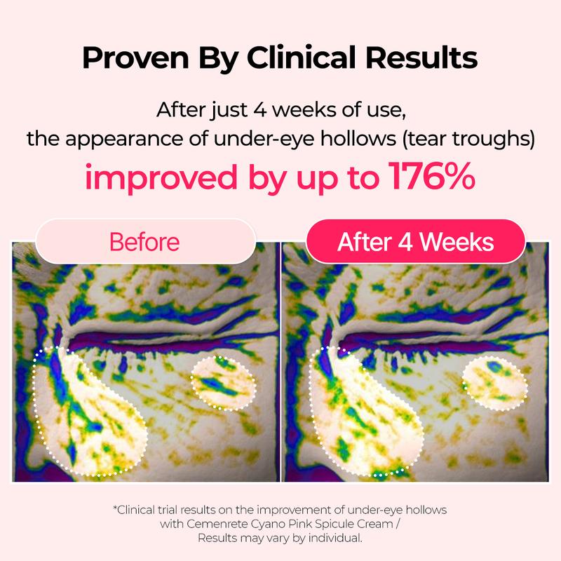 [Dr.Melaxin Official] Cemenrete Cyano Pink Spicule line | Lifting, Brightening, Dark Circles, Hydration | Korean Cosmetics