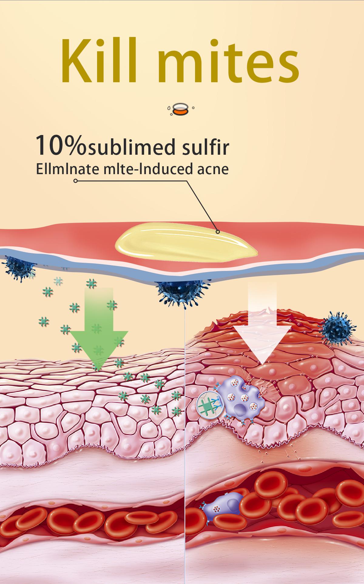 Buy 1-Get 1 Free!Tgideas All-in-One Sulfur Body Wash & Shampoo 250ml - Clear Skin, Gentle Formula, Organic Ingredients, Anti-Acne, Mite Removal, Deep Cleansing for Men & Women Cleanser Scent Buy 1-Get 1 Free!Tgideas All-in-One Sulfur Body Wash & Shampoo 250ml - Clear Skin, Gentle Formula, Organic Ingredients, Anti-Acne, Mite Removal, Deep Cleansing for Men & Women Cleanser Scent