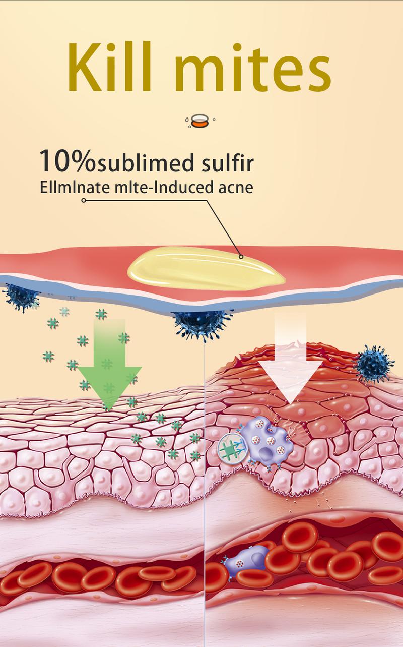 Buy 1-Get 1 Free!Tgideas All-in-One Sulfur Body Wash & Shampoo 250ml - Clear Skin, Gentle Formula, Organic Ingredients, Anti-Acne, Mite Removal, Deep Cleansing for Men & Women Cleanser Scent