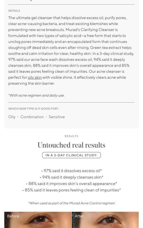 Acne Control Clarifying Cleanser