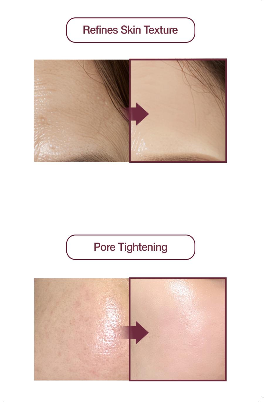 KI Stem-Cell Exosome Booster Kit + 5 Akatsuki White tomato Masks - Anti-Aging & Brightening Ampoule Set with Exosome Solution & Syringe for Radiant Skin Skincare Set Serum Essence