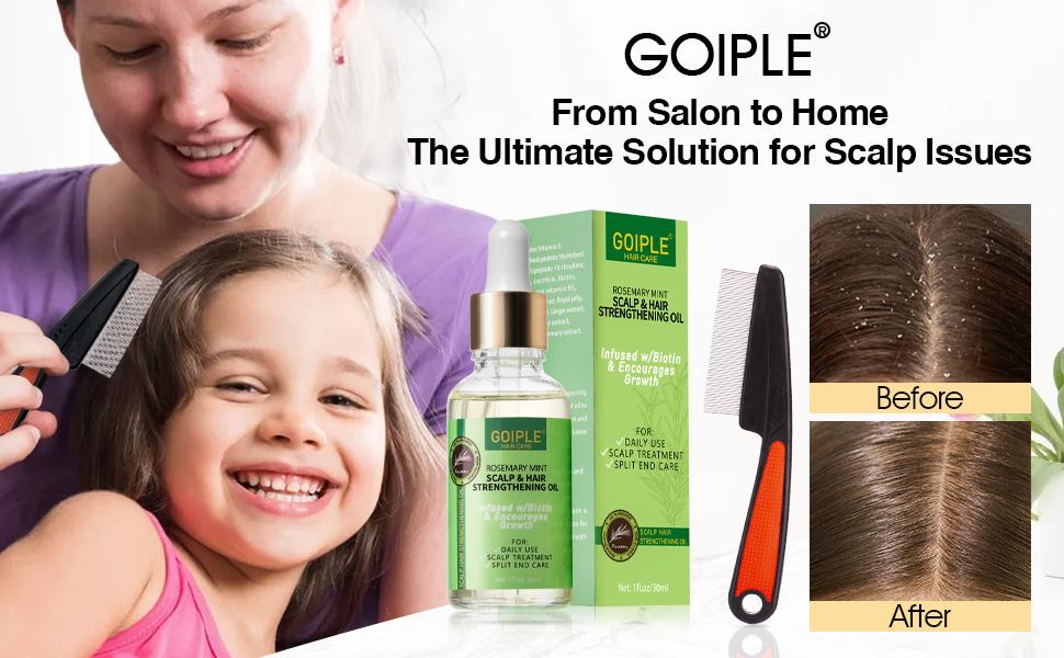 Rosemary Oil for Hair Growth & Dandruff Comb - Stainless Steel Fine Tooth Comb for Split Ends, Dry Scalp & All Hair Types Flakes Boost Shine Rosemary Oil for Hair Growth & Dandruff Comb - Stainless Steel Fine Tooth Comb for Split Ends, Dry Scalp & All Hair Types Flakes Boost Shine