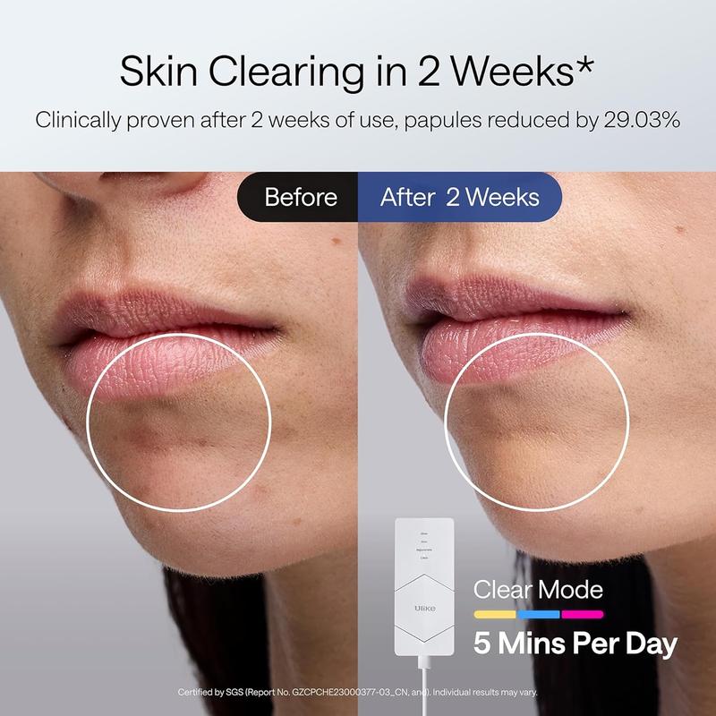 Ulike Red Light Therapy for Face, 2-Year Warranty，ReGlow LED Light Therapy Facial Mask With Red, Blue, Yellow &Infrared Red Light, 4-in-1 Modes for Firming, Rejuvenation, Brightening & Clearing, 360°Mirror Reflection