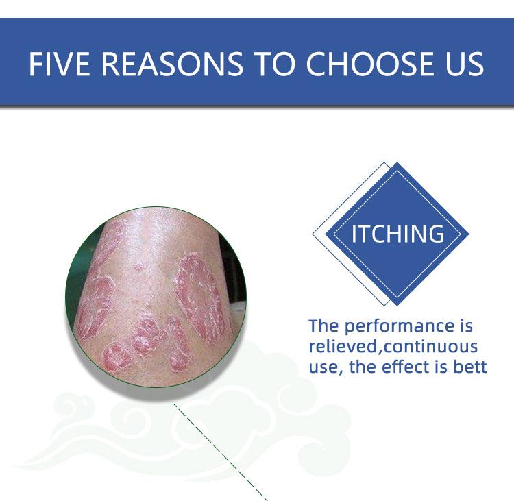 Powerful Antifungal Cream—Results in 7 Days—Effective for Psoriasis, Eczema, Ringworm, Jock Itch, Athlete's Foot, Onychomycosis, and Herpes—100% Natural Botanical Formula—Rapid Itch Relief, Prevents Recurrence, Repairs Dry, Cracked Skin Body Care Cream