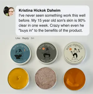 The Complete Acne Stopper Starter Pack