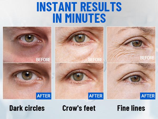 iMethod Perfection Eye Tightener - Temporary Eye Tightener Cream, Under Eye Cream, Instant Firming Formula for Fine Lines & Wrinkles, 20ml iMethod Perfection Eye Tightener - Temporary Eye Tightener Cream, Under Eye Cream, Instant Firming Formula for Fine Lines & Wrinkles, 20ml