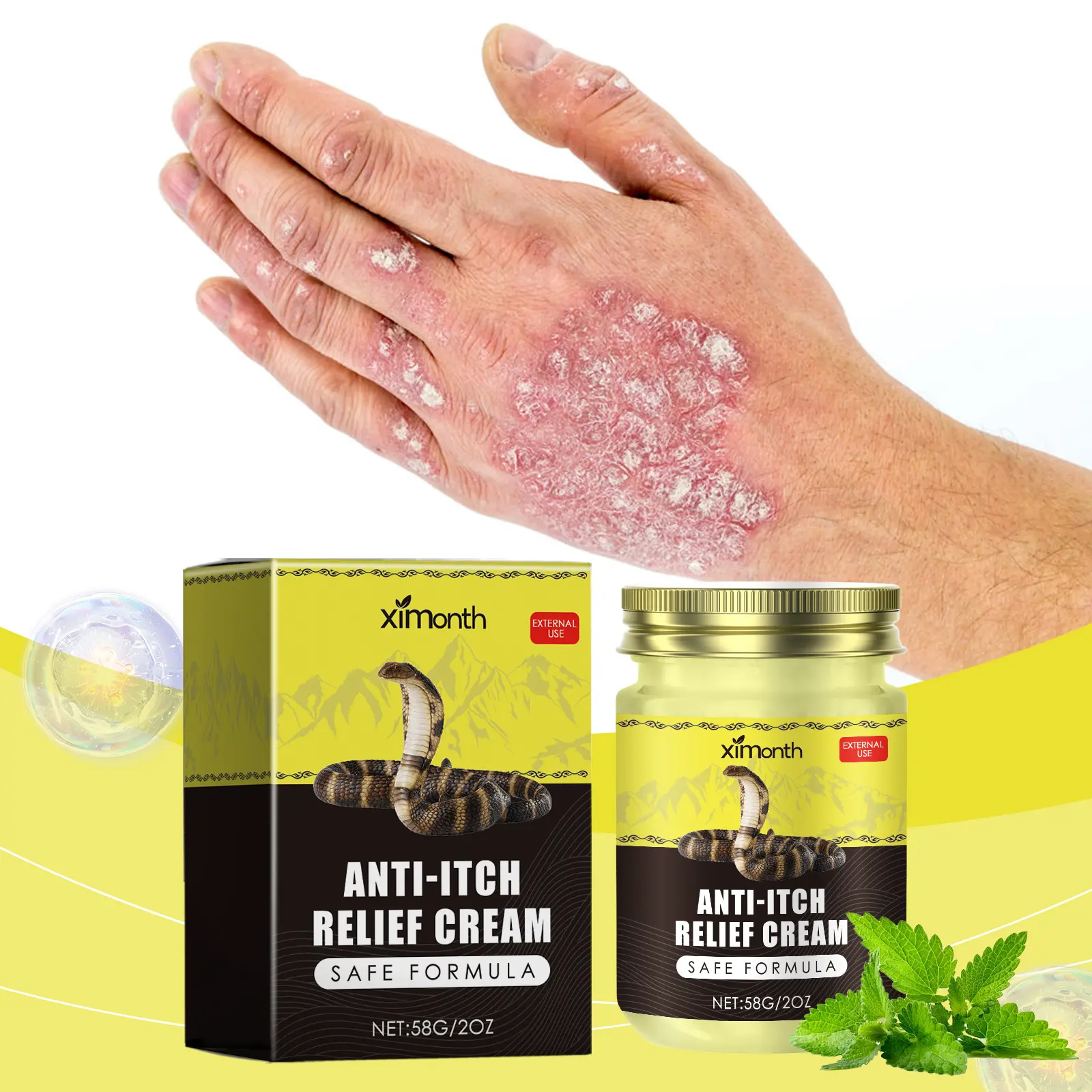 Ximonth Psoriasis Care Cream, relieves skin itching, redness and dermatitis, moisturizing skin care cream