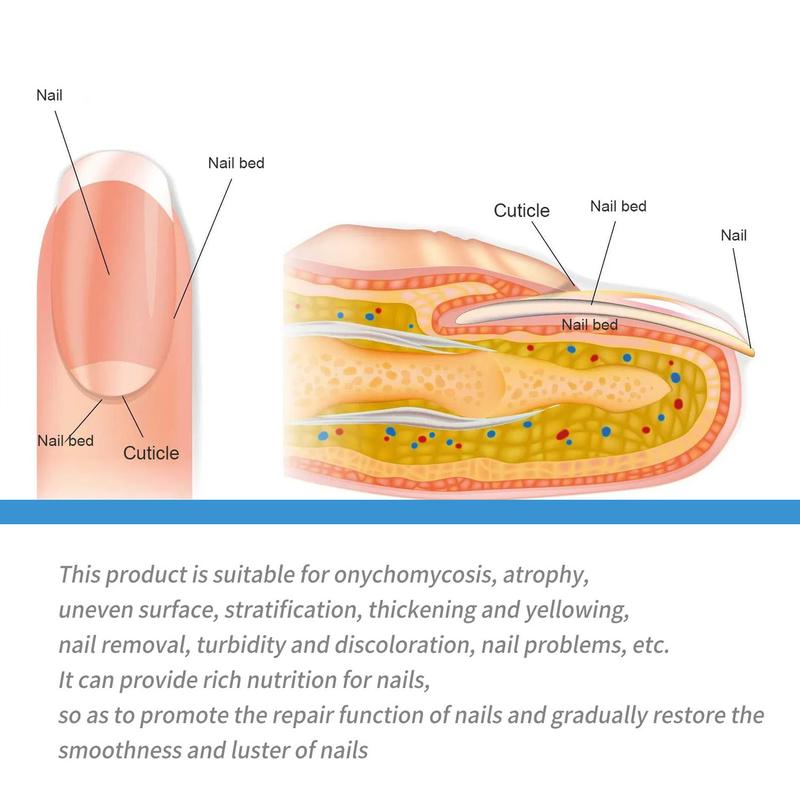Nail Fungus Treatment – Triple-Action Repair for Brittle, Thick & Discolored Nails – Ginger & Undecylenic Acid Formula, Fast-Acting, Vegan & Cruelty-Free