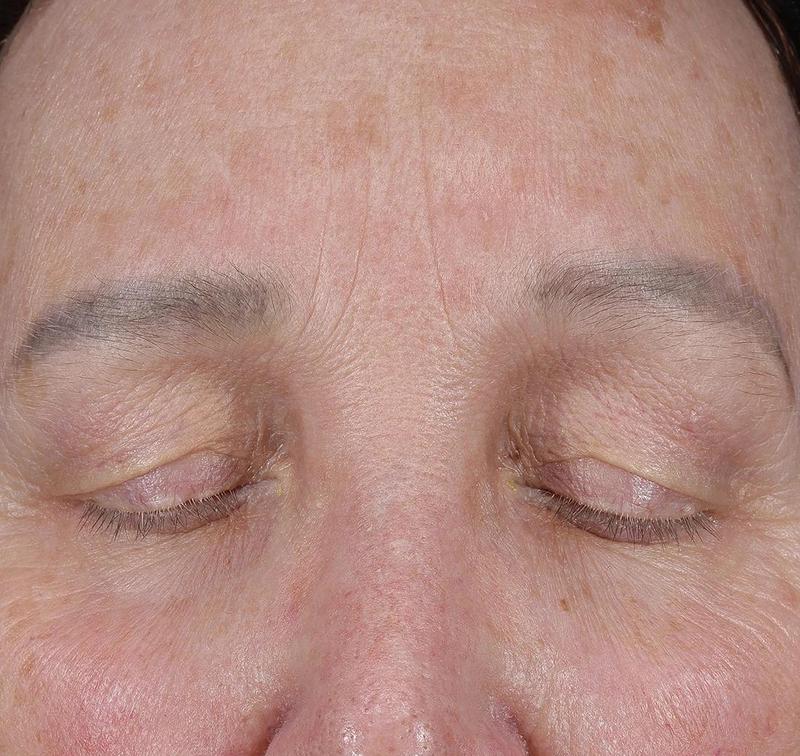 Obagi Medical ELASTIderm Lift & Sculpt Facial Moisturizer – lifts, firms, and hydrates with Bi-Mineral Complex