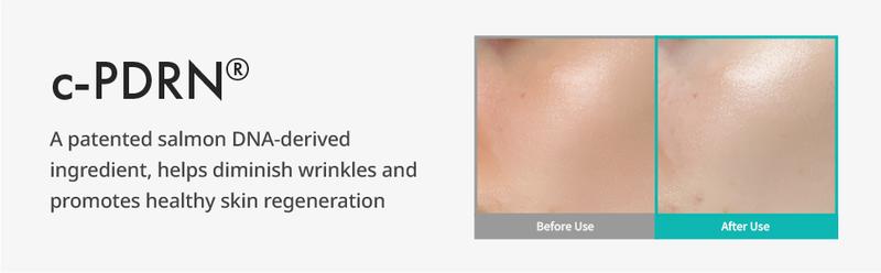 REJURAN Refreshing Emulsion, c-PDRN Moisturizers Skincare Skin Repair REJURAN Refreshing Emulsion, c-PDRN Moisturizers Skincare Skin Repair