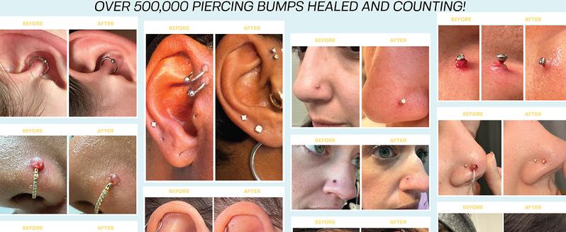 Base Laboratories Hypochlorous Acid Spray 8oz | Piercing Aftercare Spray for Bumps, Keloids & Wounds - Nose, Ears, Belly, & More - Fast Healing Solution Antiseptic Liquid Cleansing Woundspray Aid Base Laboratories Hypochlorous Acid Spray 8oz | Piercing Aftercare Spray for Bumps, Keloids & Wounds - Nose, Ears, Belly, & More - Fast Healing Solution Antiseptic Liquid Cleansing Woundspray Aid