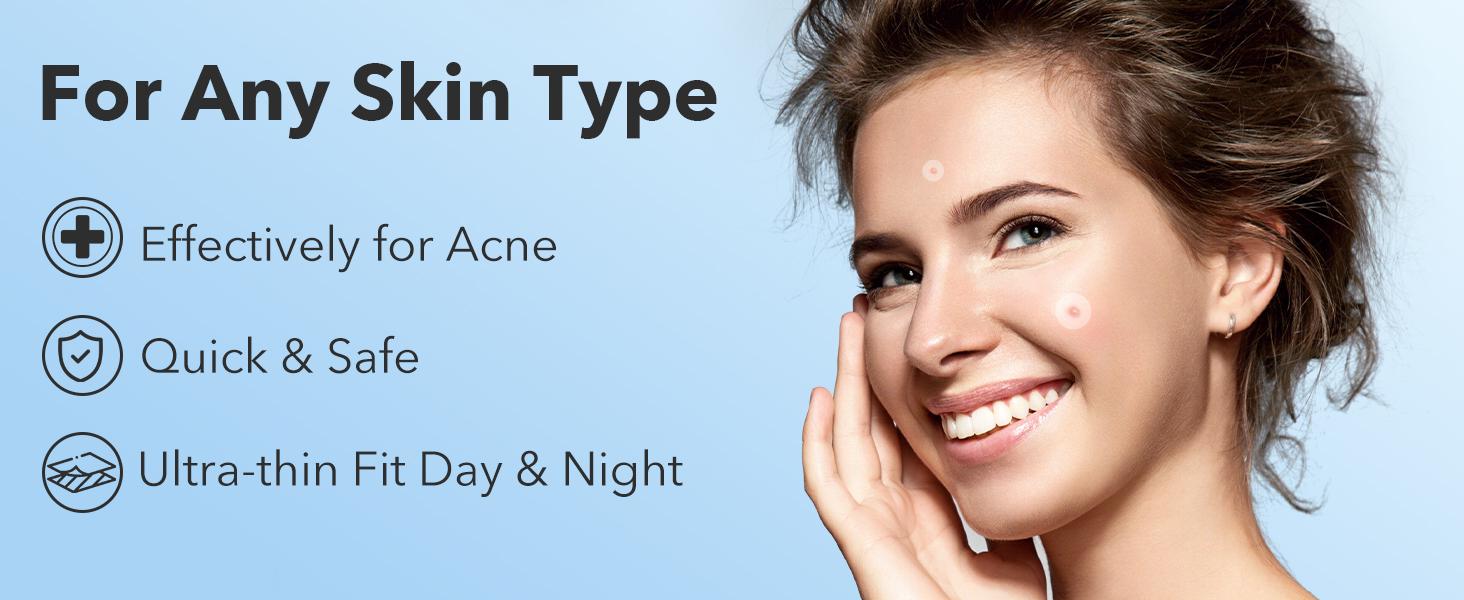 QUSTERE Pimple Patches for Face, Hydrocolloid Acne Patches, Cute Round Shape Zit Covers, Spot Stickers with Tea Tree, Salicylic Acid & Cica Oil| 2 Sizes (9mm, 12mm) |288 Count  Skincare Clear