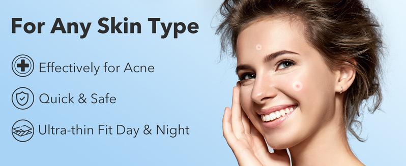 QUSTERE Pimple Patches for Face, Hydrocolloid Acne Patches, Cute Round Shape Zit Covers, Spot Stickers with Tea Tree, Salicylic Acid & Cica Oil| 2 Sizes (9mm, 12mm) |288 Count Skincare Clear QUSTERE Pimple Patches for Face, Hydrocolloid Acne Patches, Cute Round Shape Zit Covers, Spot Stickers with Tea Tree, Salicylic Acid & Cica Oil| 2 Sizes (9mm, 12mm) |288 Count Skincare Clear