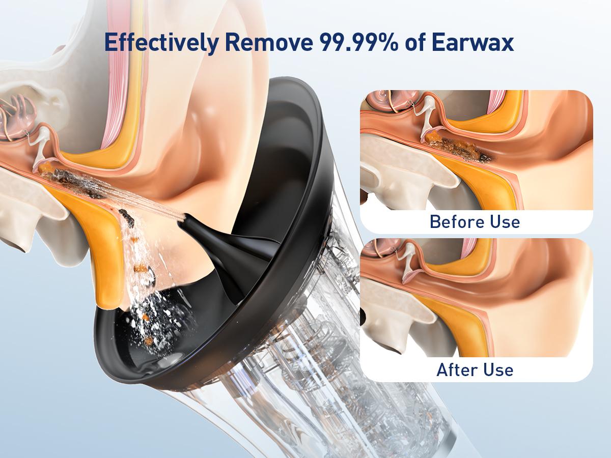 HeaDot Electric Ear Wax Removal - Water Spray,Rechargeable,Temp Detection,IPX7 Waterproof,Effective Ear Flushing System - Viral Ear Cleaner