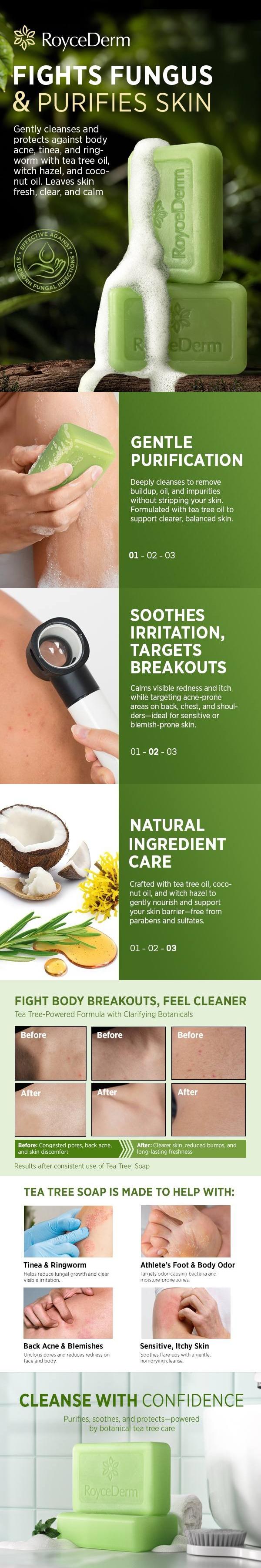 Roycederm Tea Tree Soap: Antifungal Antibacterial Treatment for Face & Body Acne, Athlete's Foot, Tinea, Folliculitis, Ringworm, and Jock Itch