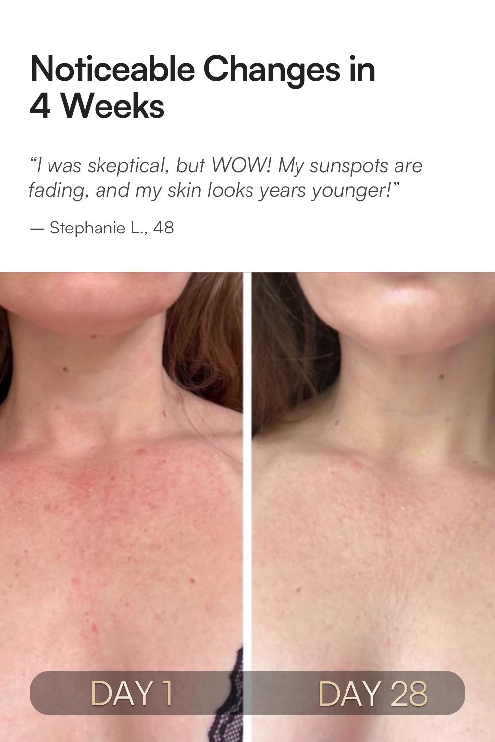 INIA GLOW Neck & Chest Red Light Mask – 850nm NIR LED Mask for Wrinkle & Spot Reduction, Lift & Firm in 4 Weeks, Rechargeable 2600mAh Controller, Clinic-Grade Full Coverage, Best Valentine's Day Gift for Her