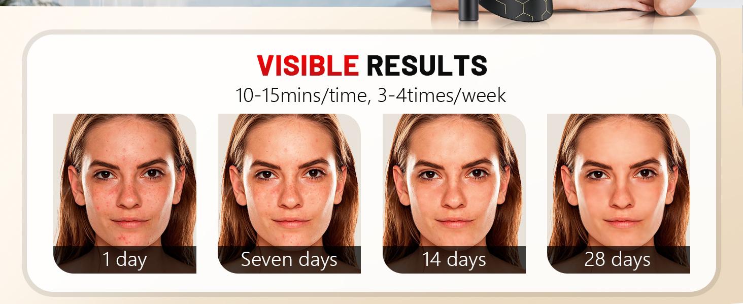 Red Light Therapy Mask for Face 8 Modes LED Face Mask Light Therapy with 288 LEDs 630nm & 850nm Infrared Light Therapy Mask at Home Portable with Timer & 2600mAh Remote Control for Anti-Aging