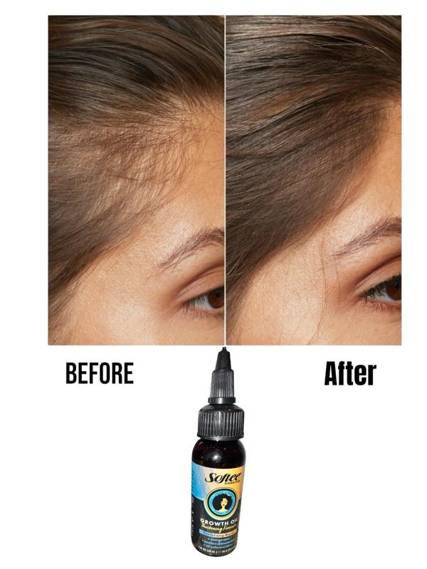 2 X Hair Growth Oil, Thickening formula, revitalizing repair, damage repair, moisture replenishment, all natural oil blend,Softee Signature Hair Health,Fl Oz (28g)