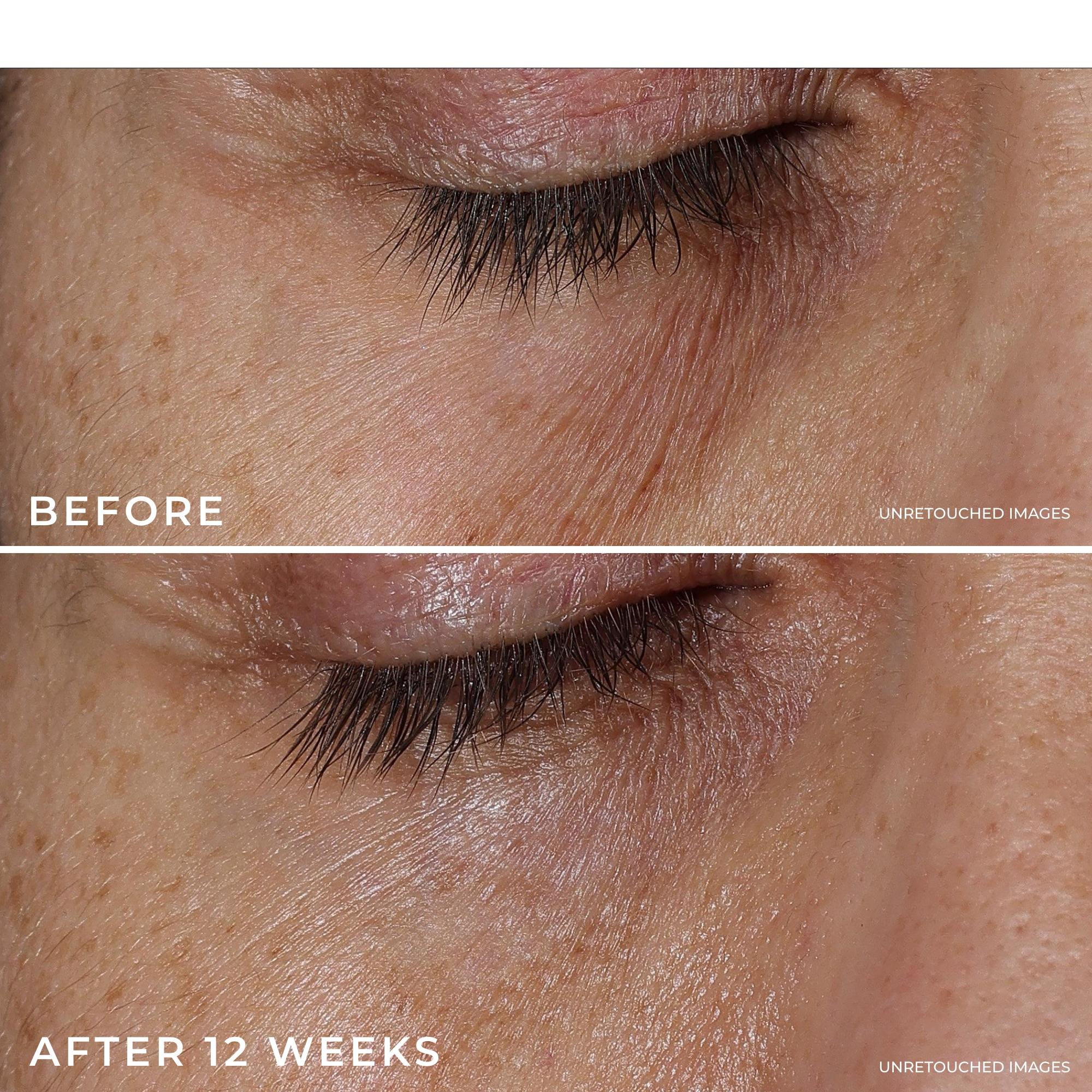 [RoC Skincare] DERM CORREXION Eye Repair Dark Circle Cream