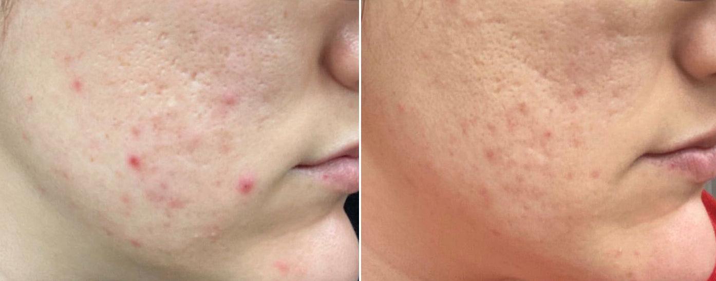 Clear Genius Toner + Serum