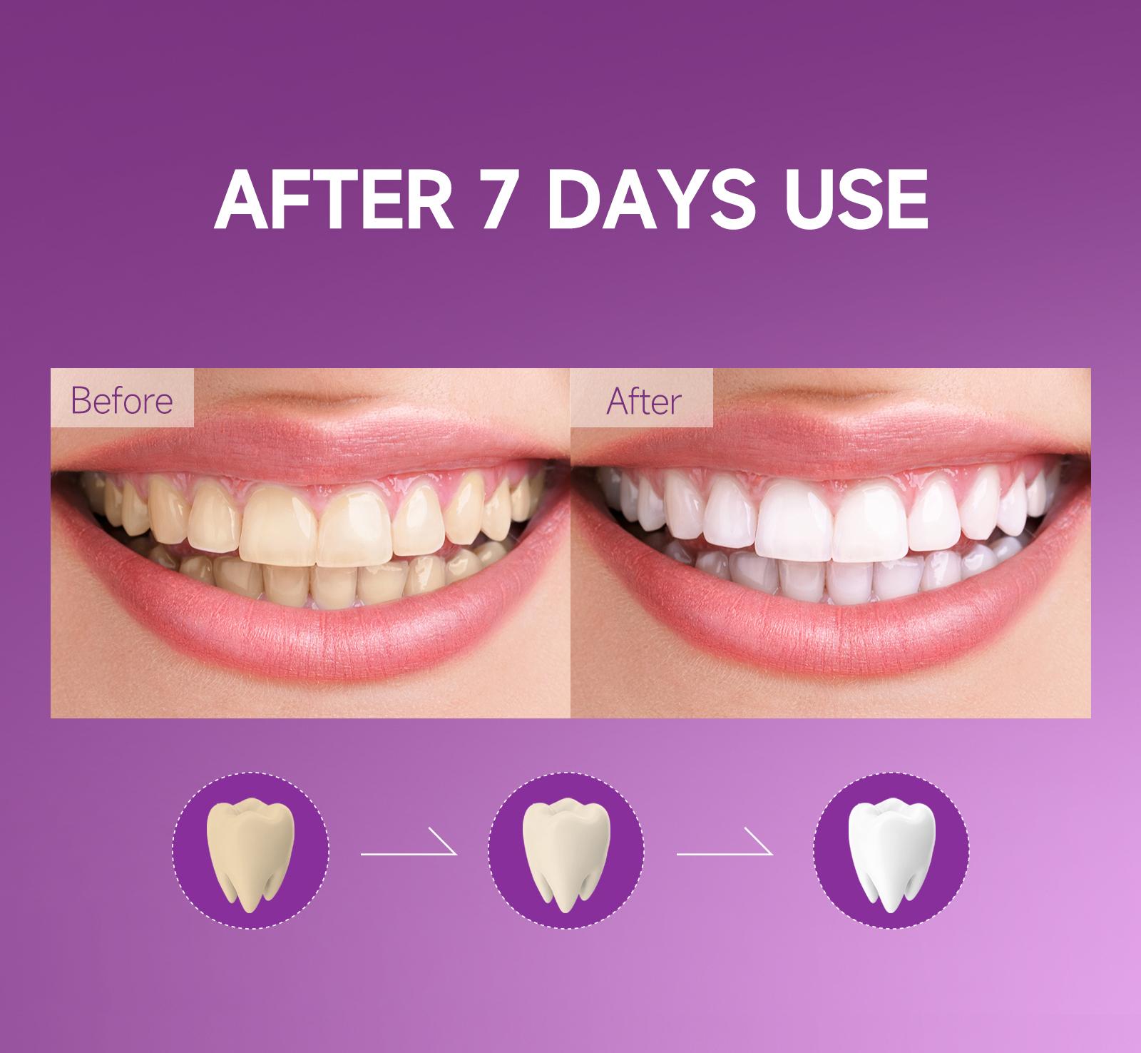 Toothgeek Mint Pap Teeth Strips – 7-Day Use Gentle Formula, Clean Feel, Mint Flavor, Purple Fun Stickers