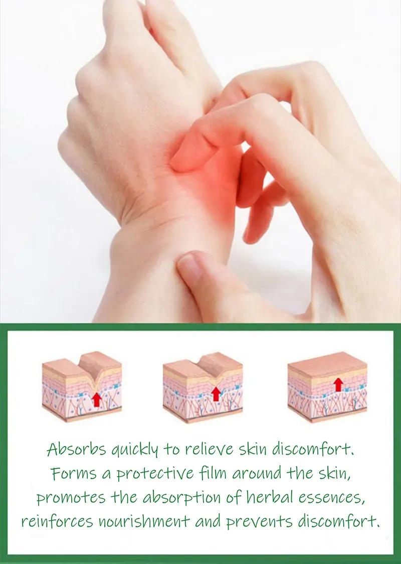 Calming Antimicrobial Cream - Soothes Eczema Flare-Ups, Jock Itch, Dry Itchy Skin | Fragrance-Free Mild Formula for Legs, Hands, Groin & Full Body | Hypoallergenic & Non-Greasy