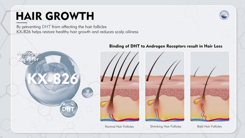 KOSHINÉ 0.9% KX-826 DHT Blocker Hair Thickening Growth Products – Suitable for Men and Women (Purple Bottle)