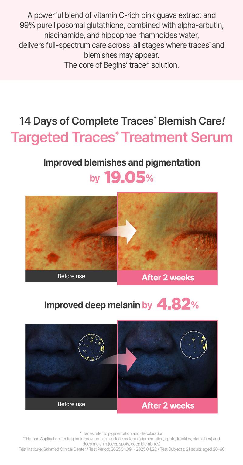 [BeginS by JUNGSAEMMOOL] Pink Guava Glutathione Blemish Serum | Korean Facial Serum | 10% Niacinamide, Vitamin C-rich Jeju Guava for Dark Spot Care and Radiant Glass Skin (1.01 Fl Oz)