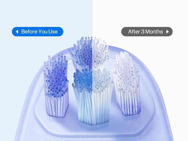 usmile Y20 PRO AI Powered Electric Toothbrush, Personalized Cleaning with 25x More Plaque Removal and 90-Day Battery Life