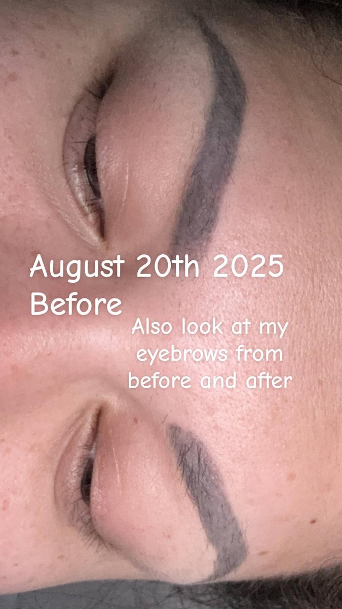 Item: 3 Month Supply (2 mL)