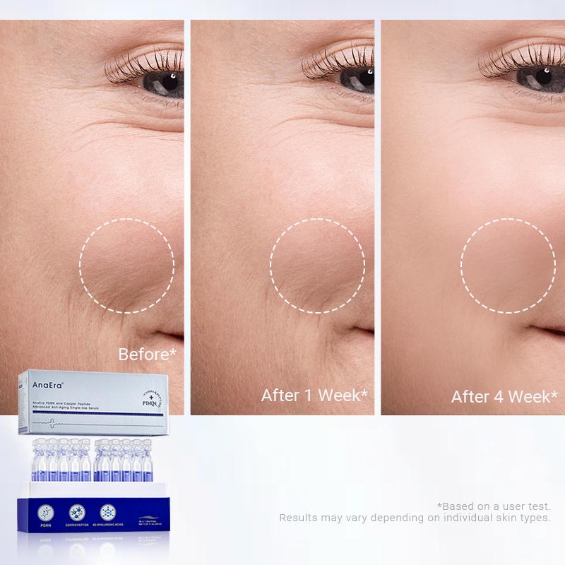 AnaEra Pro-Grade Age Reset Set | Choose Your Hero Serum: 5% HA Ampoule OR PDRN+Copper Peptide | Prevent Skin Aging | BFS Sterile Technology | Target Wrinkles, Loss of Firmness & Dryness AnaEra Pro-Grade Age Reset Set | Choose Your Hero Serum: 5% HA Ampoule OR PDRN+Copper Peptide | Prevent Skin Aging | BFS Sterile Technology | Target Wrinkles, Loss of Firmness & Dryness