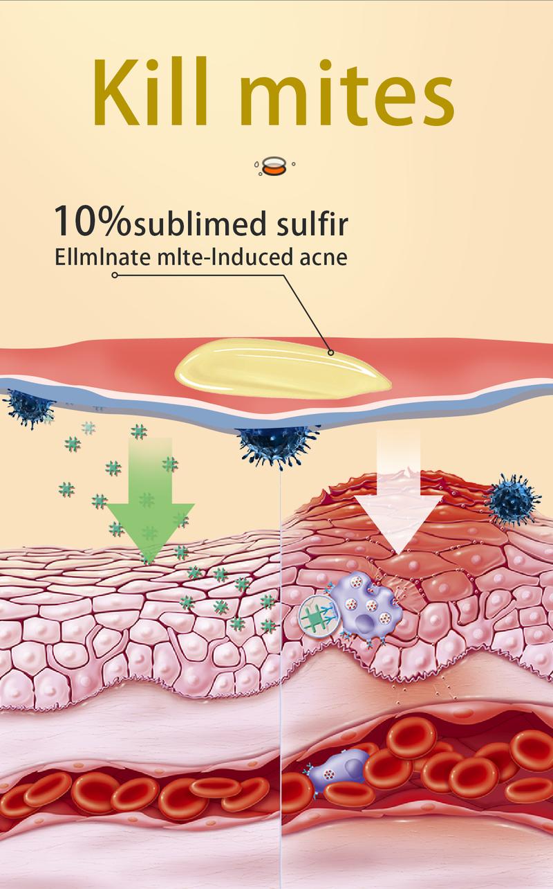Buy 1 Get 1 Free! Tgideas All-in-One Sulfur Shampoo 250ml - Refresh Scalp, Gentle Formula, Organic Ingredients, Reduce Flakiness, Deep Cleansing for Men & Women Cleanser Scent Buy 1 Get 1 Free! Tgideas All-in-One Sulfur Shampoo 250ml - Refresh Scalp, Gentle Formula, Organic Ingredients, Reduce Flakiness, Deep Cleansing for Men & Women Cleanser Scent