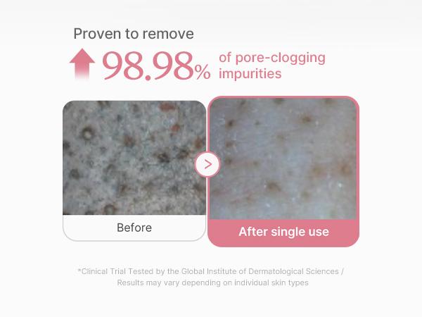 [medicube official] PDRN Marshmallow Whip Cleanser | Face Wash, Cleansing Foam for Pore Care & Uneven Skin Tone | Gentle Daily Deep Cleansing | Hydrating and Nourishing Facial Cleanser | Korean Skincare | 4.2 oz