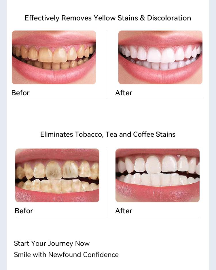 Luha Teeth Whitening Powder for Yellow Teeth Tea Coffee Stains Tartar Plaque 14 Days to 5 Shades Whiter Non Medical Oral Oral Oral