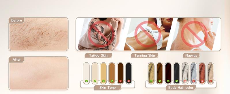 【CLEARANCE SALE】At-Home IPL Hair Removal Device, Permanent Laser Hair Removal Device for Body,Face,Bikini Line,Legs,Armpit,Unlimited Flashes, FDA Cleared IPL device, Comfort,Smoothness,Portable. 【CLEARANCE SALE】At-Home IPL Hair Removal Device, Permanent Laser Hair Removal Device for Body,Face,Bikini Line,Legs,Armpit,Unlimited Flashes, FDA Cleared IPL device, Comfort,Smoothness,Portable.