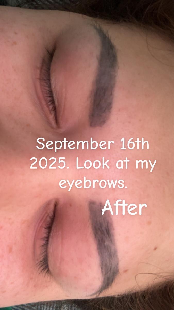 Item: 3 Month Supply (2 mL)