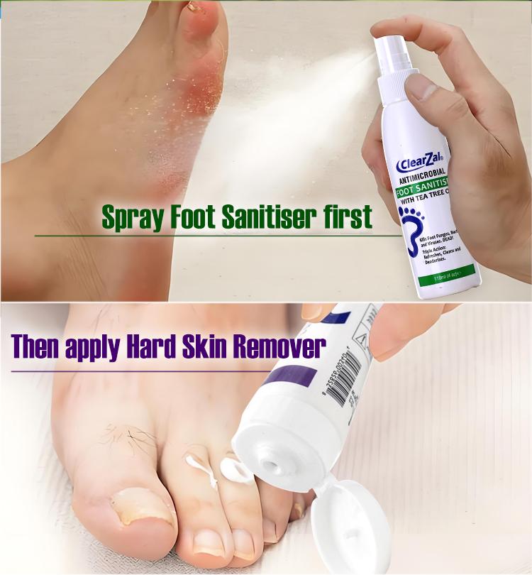 Clearzal Dry  Cracked Feet Repair Ultra-Hydrating Hand and Foot Cream Hard Skin Moisturizer, 3.5 oz. Contains Urea, Salicylic Acid, for Dry, Chapped, Cracked Feet, Dead Skin Remover, For Thick, Cracked, Rough Skin , dead skin and dry skin cream repair