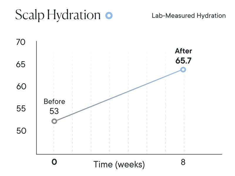 Qure Showerhead filter for Hard Water - Get healthier Hair, Skin & Nails by reducing 99,9% Chlorine | High Pressure Shower head, Improve your Beauty and Skincare Routine, Dermatologist-approved