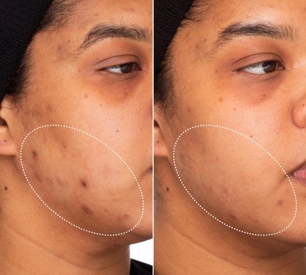 INNBEAUTY PROJECT Green Machine Serum - Dark Spot Corrector with Vitamin C, Azelaic Acid, & 15 Superfoods for Radiant Skin INNBEAUTY PROJECT Green Machine Serum - Dark Spot Corrector with Vitamin C, Azelaic Acid, & 15 Superfoods for Radiant Skin