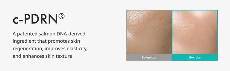 REJURAN Refining Foam Cleanser, c-PDRN – Hydrating & Gentle for Smoother, Clearer Skin, Minimizes Pores & Balances with Hyaluronic Acid & Tanin Complex, Korean Skin Care (4.05 fl oz)