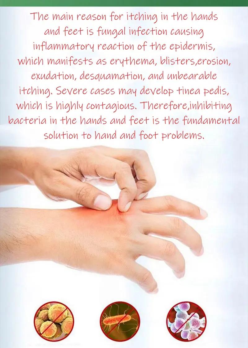 Calming Antimicrobial Cream - Soothes Eczema Flare-Ups, Jock Itch, Dry Itchy Skin | Fragrance-Free Mild Formula for Legs, Hands, Groin & Full Body | Hypoallergenic & Non-Greasy