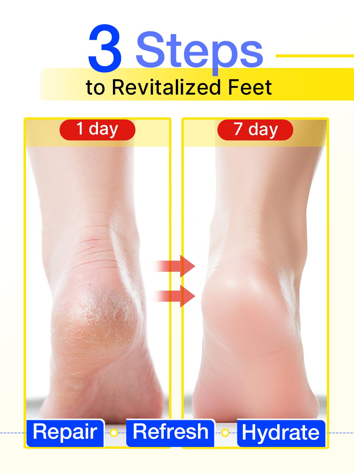 FOOT RESCUE - Advanced Restorative Treatment - Urea Foot Repair Cream - Salicylic Acid Foot Ointment