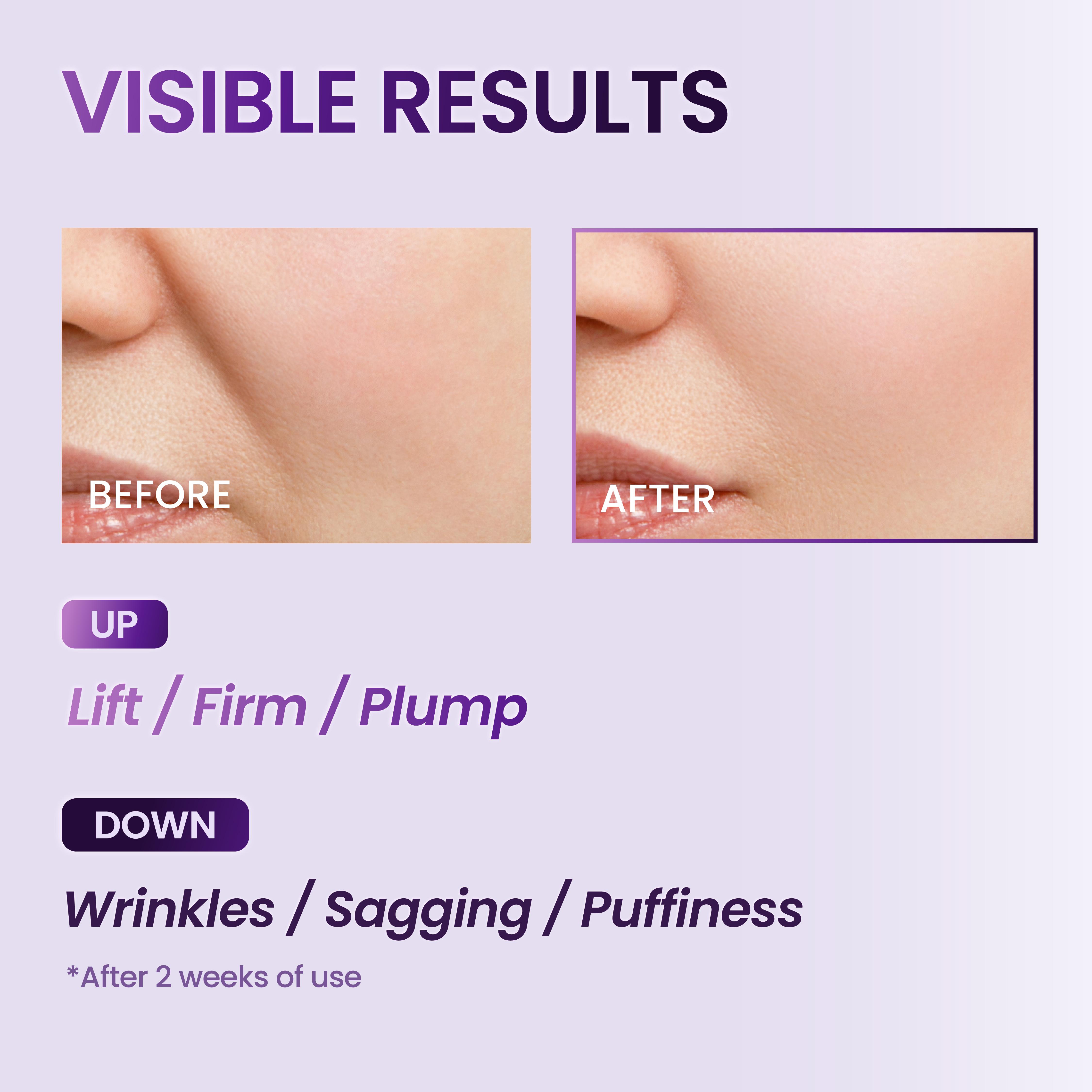 BIOHEAL BOH Probioderm 3D Lifting Skincare Set | Anti-Aging Face Moisturizer Night Cream, Ampoule & Facial Serum Spray | Korean Skin Care Kit for Firming & Hydration | K Beauty Gift Set for Women