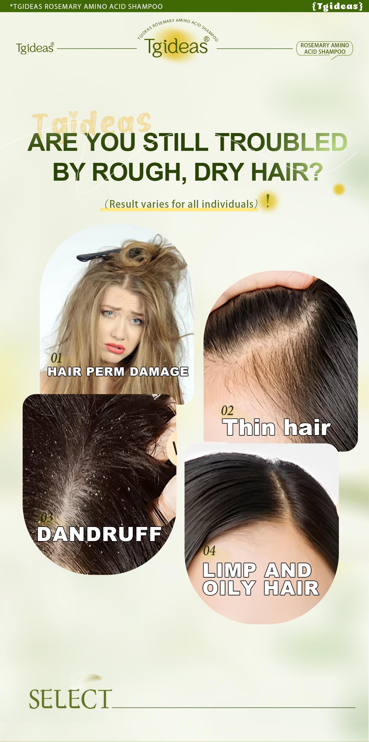 Tgideas Rosemary Batana Oil Shampoo - Promotes hair growth, strengthens hair strands, cleanses hair, contains natural extracts to care for hair, daily hair care 250ml (8.45oz).