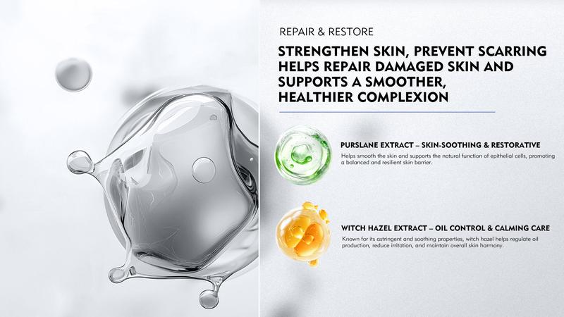 KOSHINÉ KX-826 Anti-Acne Gel | Advanced Skincare for Clearer, Balanced Skin Suitable for Men and Women(50ml))